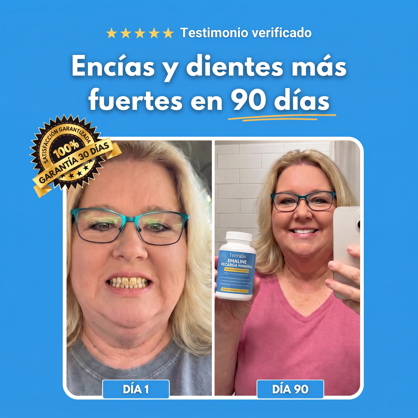 Resultado antes y después con Emaline