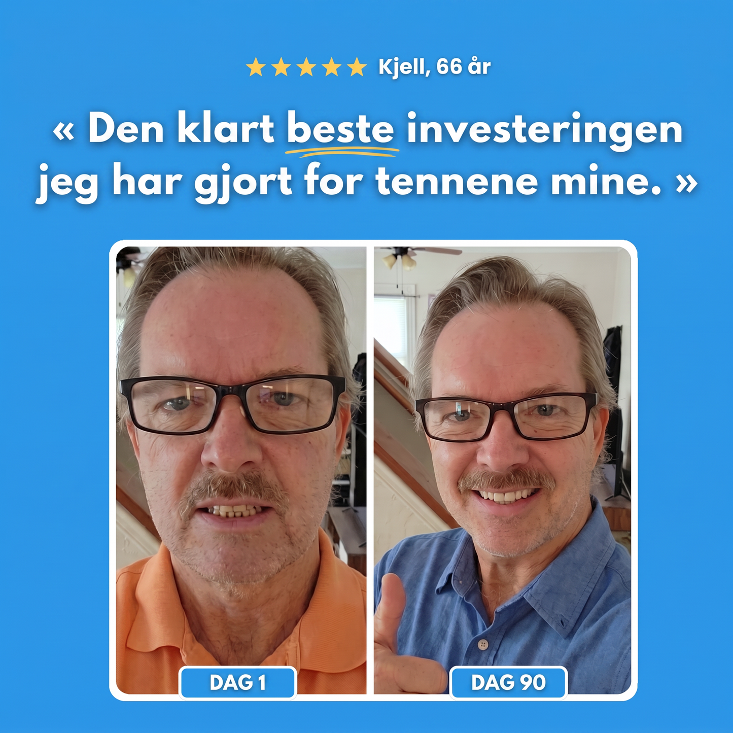 Kundehistorie før og etter med Emaline